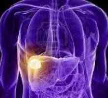Tumorile benigne ale ficatului