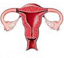 Hipoplazie ovarian