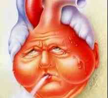 Insuficiență cardiacă cronică