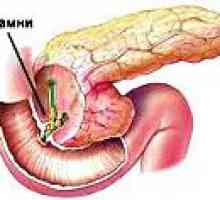 Pietre pancreas