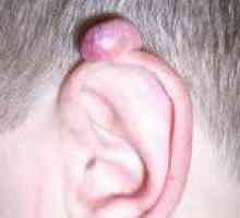 Tumorile urechii