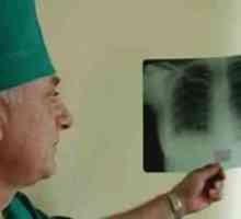 Tuberculoză pulmonară