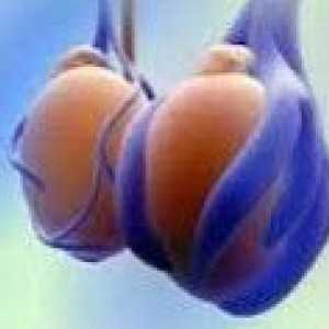 Hipoplazia testicule