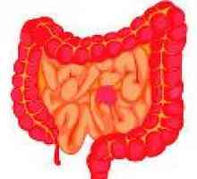Abces intestinal