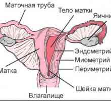 Adenomioza (endometrioza, corp uterin)