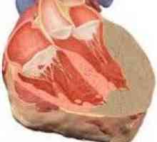 Amiloidoza cardiacă