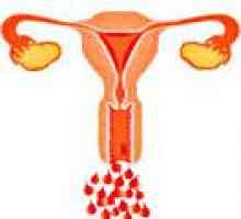 Sângerări uterine anovulatorie