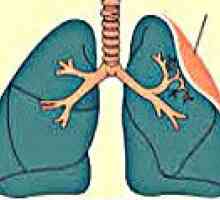 Atelectazie pulmonară