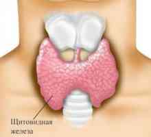 Tiroidita autoimuna (tiroidita Hashimoto)