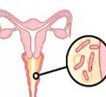 Vaginita bacteriana