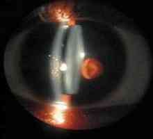 Ochii biomicroscopie