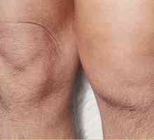 Durere în genunchi (articulația genunchiului)