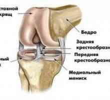 Dureri în articulația genunchiului