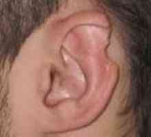 Deformarea urechi