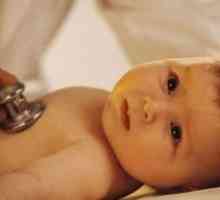 Deformarea vezicii biliare la un copil