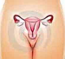 Disfuncții ovariene