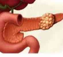 Tumorile benigne ale pancreasului