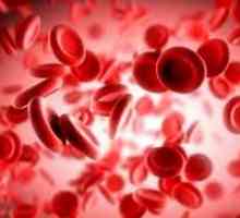 Anemie hemolitică