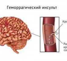 Accident vascular cerebral hemoragic