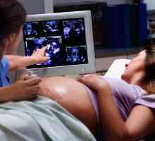 Hipoplazia osului nazal la fetusi
