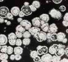 Pneumonie fungice