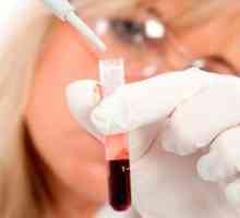 Sângele va ajuta la determinarea tendinta de a bolii