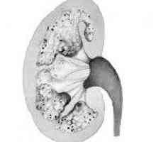 Burete de rinichi