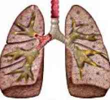 Pneumonie cronică