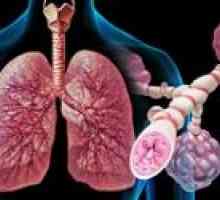 Boli pulmonare cronice nespecifice