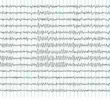 Electroencefalograf (EEG)