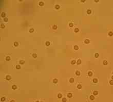 Celulele roșii ale sângelui în urină