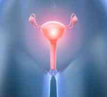 Eroziune de col uterin