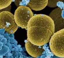 Cum este Staphylococcus aureus