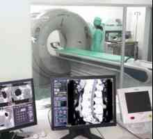 Tomografie computerizata (CT tomografie), X-ray