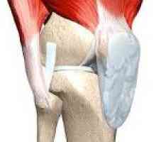 Contractura articulației genunchiului