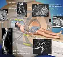 Imagistica prin rezonanta magnetica (IRM). Indicații, contraindicații, RMN