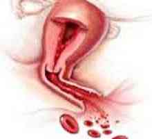 Hemoragie uterină