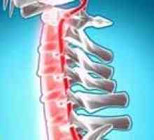 Încălcări ale circulației spinării