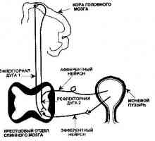 Vezica urinara neurogena