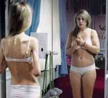 Anorexia nervoasă