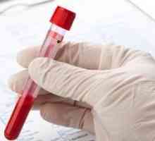 Hemoglobinei (anemie)