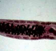 Opisthorchiasis (boala lui Vinogradov)