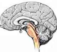 Tumorile trunchiului cerebral