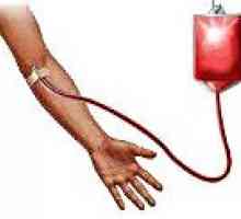 Complicații post-transfuzie