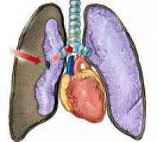 Leziuni pulmonare