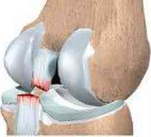 Deteriorarea ligamentele genunchiului