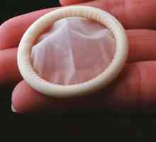 Prezervativ