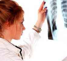Simptomele cancerului pulmonar la un stadiu incipient