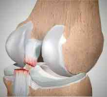 Ruperea ligamentelor genunchiului