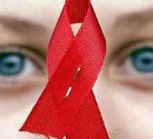 Simptome de HIV